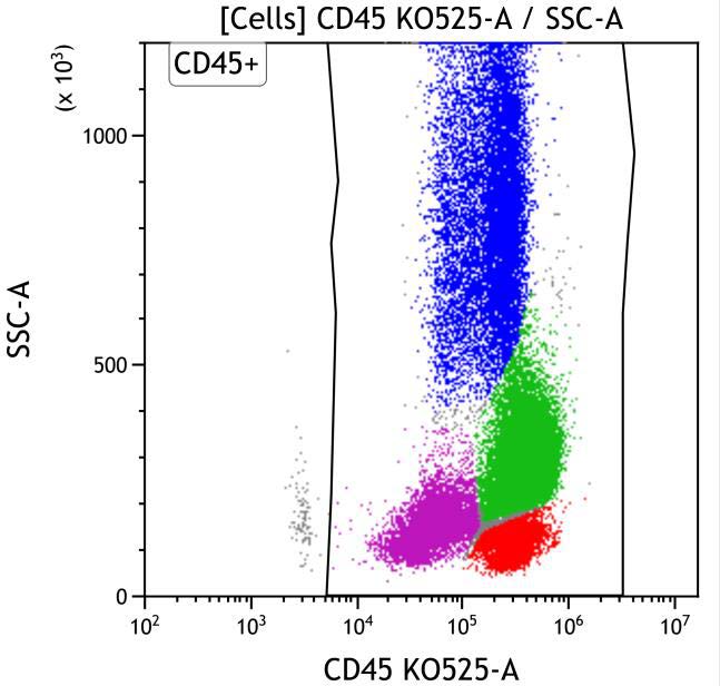 Casebook ClearLLab 10C, case 7, illustration M1-04, CD45 vs Side scatter, Gated on Cells
