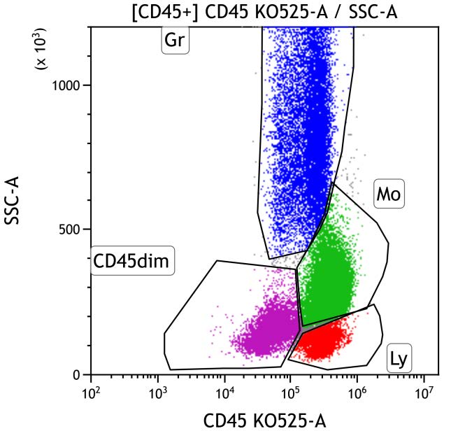 Casebook ClearLLab 10C, case 7, illustration M1-05, CD45 vs Side scatter, gated on CD45+