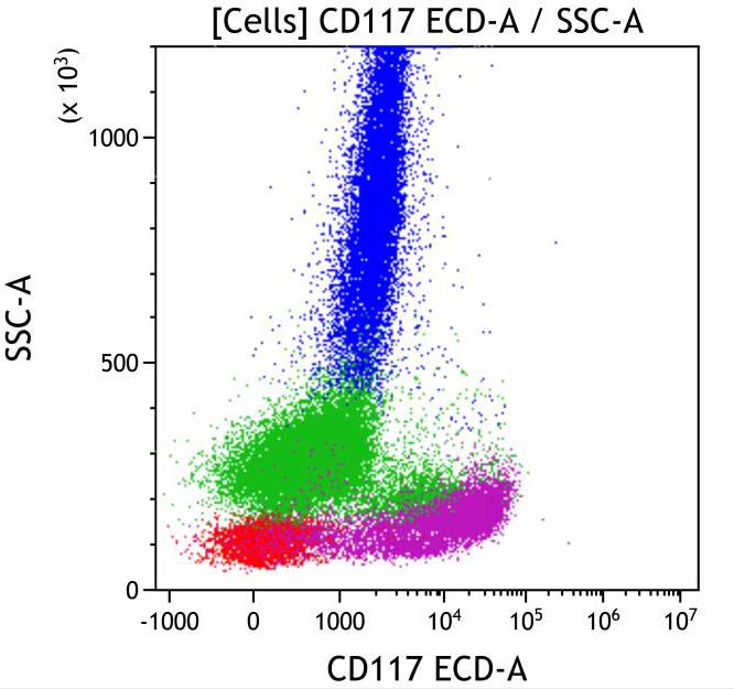 Casebook ClearLLab 10C, case 7, illustration M2-08, CD117 vs Side scatter, gated on Cells