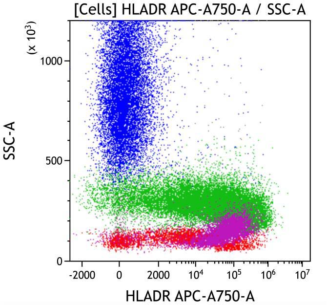 Casebook ClearLLab 10C, case 7, illustration M2-13, HLA-DR vs Side scatter, gated on Cells