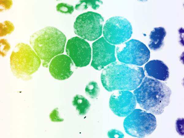 Flow Cytometry