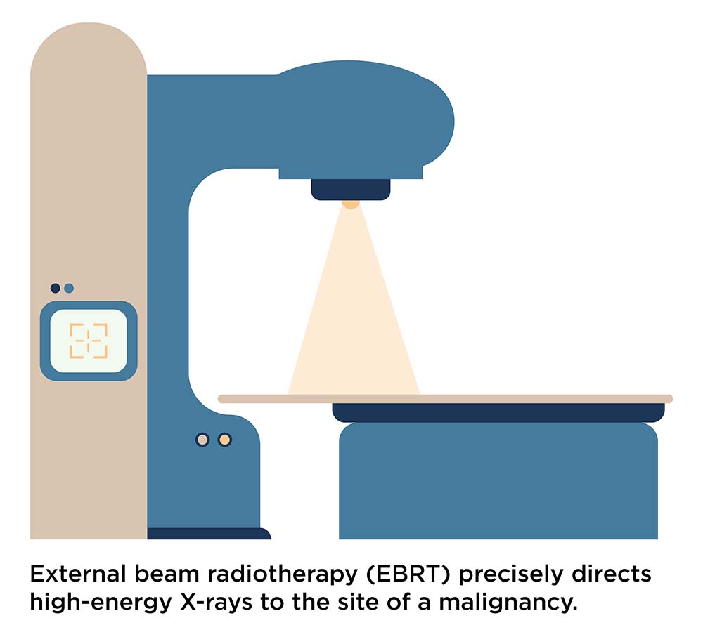 Drawing of EBRT machine