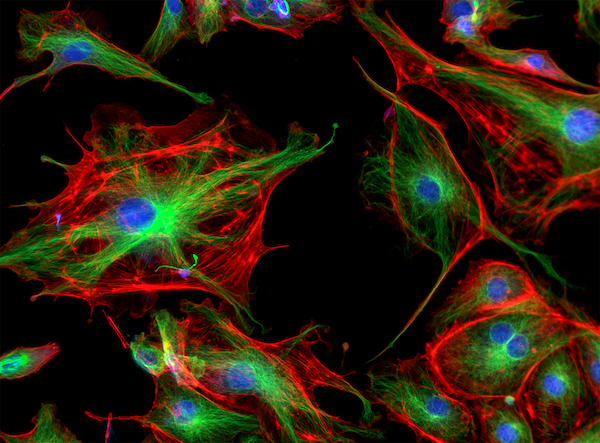 Bovine Pulmonary Artery Endothelial Cells (BPAE) stained for mitochondria, phalloidin, and nuclei.