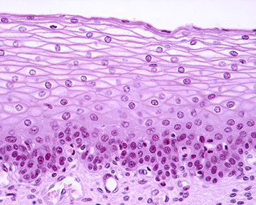 Epithelial cells