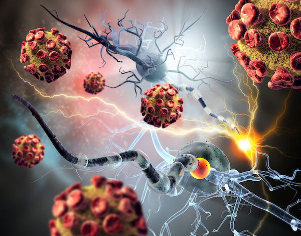 3D illustration of viruses attacking nerve cells.